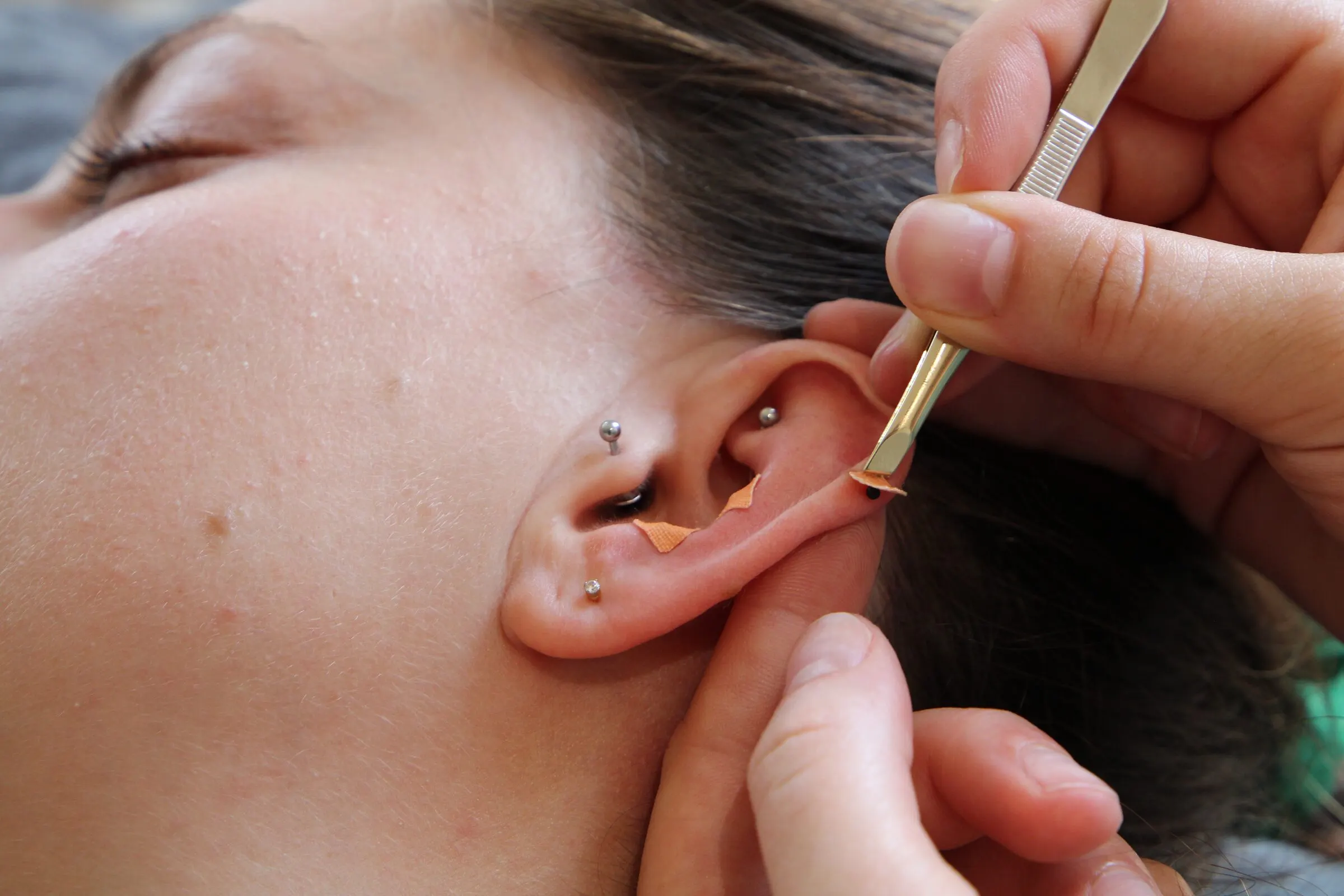 Réflexologie auriculaire : stimulation du pavillon de l’oreille au stylet